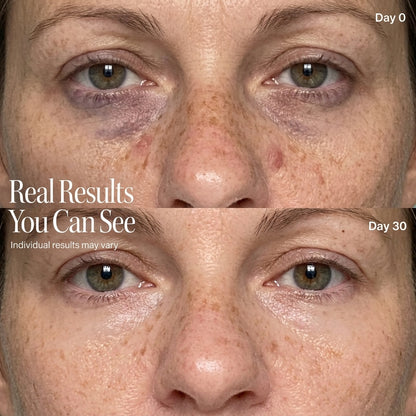 KRSTL.™ Red Light Eye Cream — 3-in-1 Under Eye Treatment